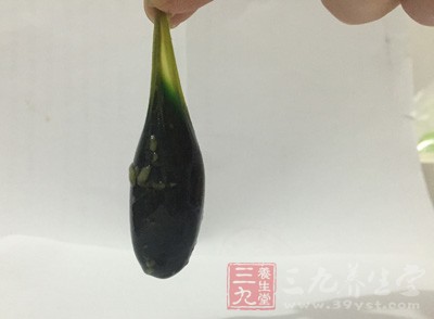 有些偏方切勿亂信，近些日子，一寧波先生聽朋友說魚膽可以清熱解毒，於是獨自生吞了一條魚的魚膽治上火，結果沒想到直接被送進醫院重症監護室搶救!