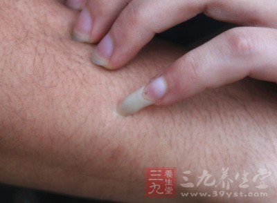 它可以通過消化道、呼吸道、皮膚損傷和眼結膜等多種途徑傳播 它可以通過消化道、呼吸道、皮膚損傷和眼結膜等多種途徑傳播