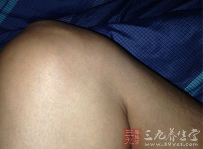 大關節處就比較難發現 大關節處就比較難發現