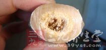 這些食物吃太多當心肚裡髒得嚇人