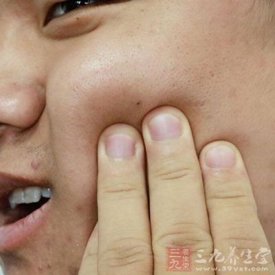 早期隔離患者直至腮腺腫脹完全消退
