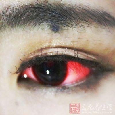 喝酒危害視力，尤其是喝酒之後會眼睛紅的人群