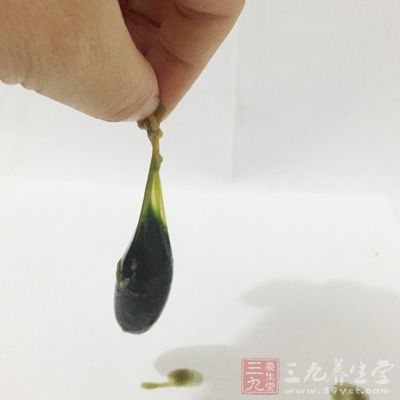 魚膽汁中毒緊急措施 魚膽汁中毒緊急措施