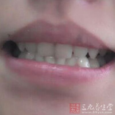 產後如果不刷牙,可以使大量細菌積存在牙垢裡,增加了牙龈感染的機會 產後如果不刷牙,可以使大量細菌積存在牙垢裡,增加了牙龈感染的機會