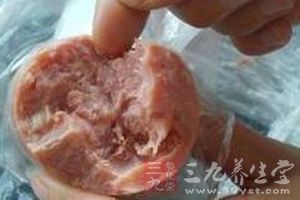火腿含鹽量高，屬高鈉食品，高血壓患者和老年人不宜食用