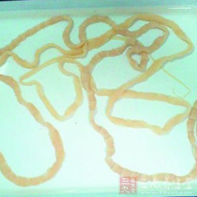 肝吸蟲蟲體大小為5~10毫米,而人的肝髒約兩個手掌大小 肝吸蟲蟲體大小為5~10毫米,而人的肝髒約兩個手掌大小