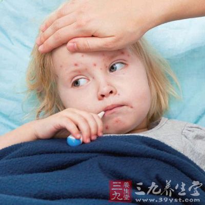 小兒得荨麻疹不能吃什麼