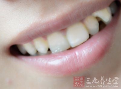 他們覺得自己的牙齒泛黃