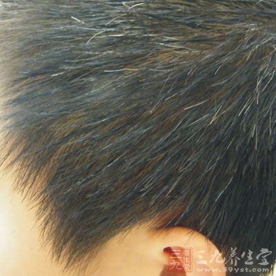 少白頭的發生多與精神因素、營養不良、內分泌障礙以及全身慢性消耗 性疾病有關