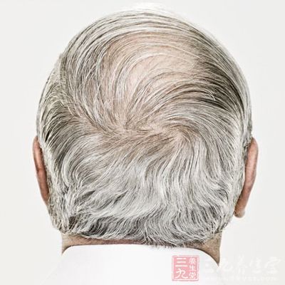 頭頂、後腦勺白發—腎髒