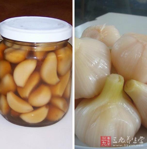 糖、醋漫泡1個月以上的大蒜瓣若干,每天吃6瓣蒜,並飲其糖醋汁20毫升,連服1個月,適用於頑固性高血壓。 糖、醋漫泡1個月以上的大蒜瓣若干,每天吃6瓣蒜,並飲其糖醋汁20毫升,連服1個月,適用於頑固性高血壓。